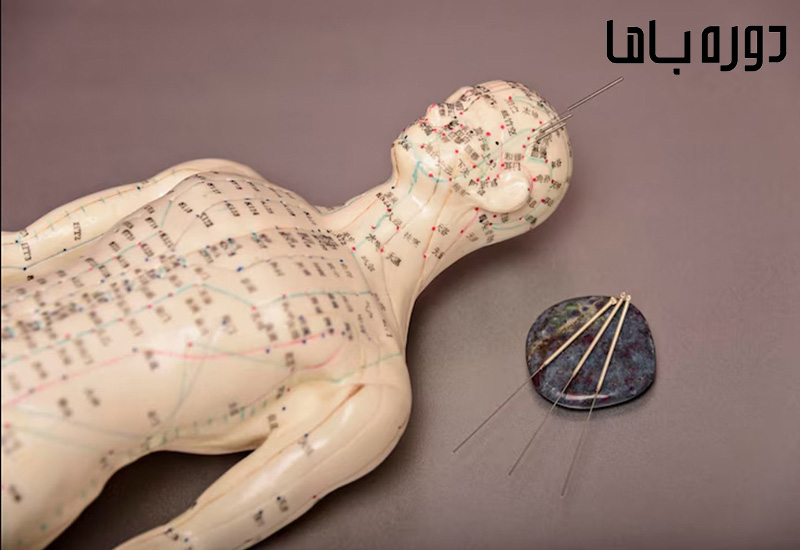 نقاط طب سوزنی