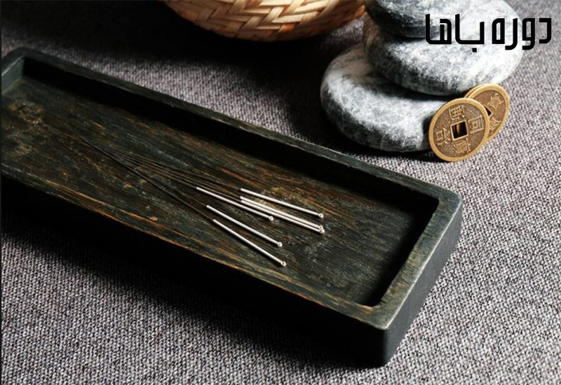 نقاط طب سوزنی برای استرس